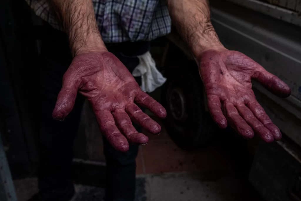 Le condizioni delle mani durante la produzione di vino.